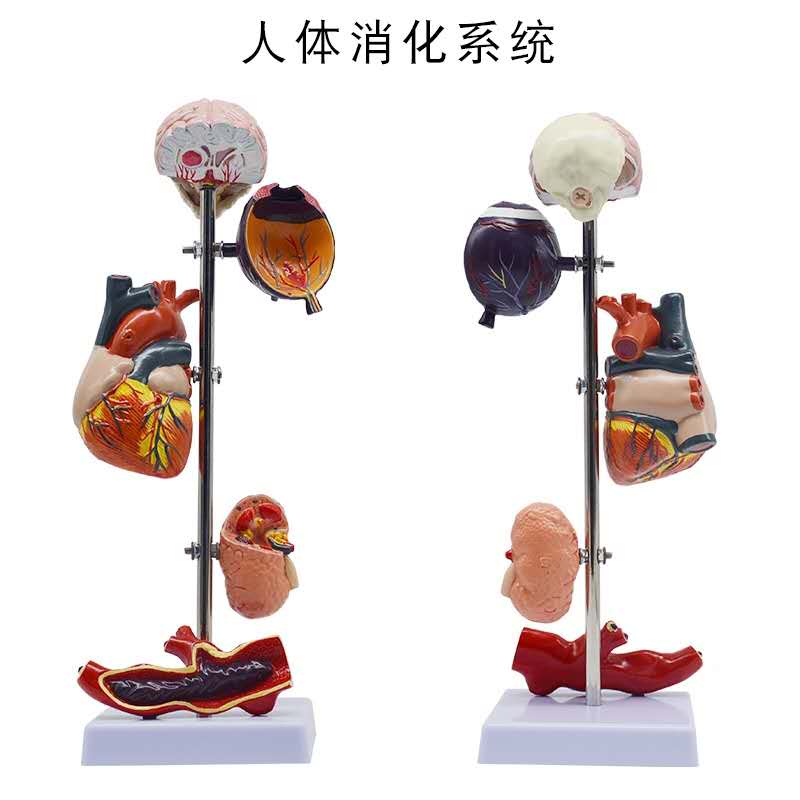 Presentation model of compli of glucosepathy high/high blood pressure pathology presentation model of three finger peaks
