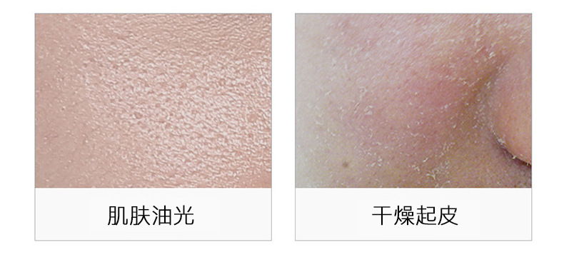 Wholesale Nicotinamide Blue Copper Peptide Lotion Rich Moist Lotion Moisturizing Hydrating Soothing Skin Care Water Supple Skin Water Wholesale Nicotinamide Blue Copper Peptide Lotion Rich Moist Lotion Moisturizing Hydrating Soothing Skin Care Water Supple Skin Water