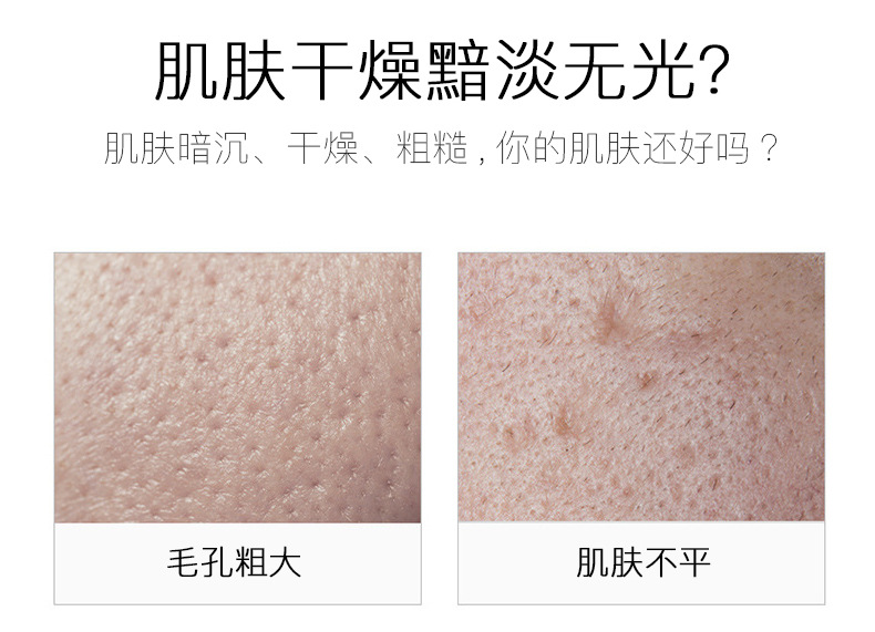 Wholesale Nicotinamide Blue Copper Peptide Lotion Rich Moist Lotion Moisturizing Hydrating Soothing Skin Care Water Supple Skin Water Wholesale Nicotinamide Blue Copper Peptide Lotion Rich Moist Lotion Moisturizing Hydrating Soothing Skin Care Water Supple Skin Water