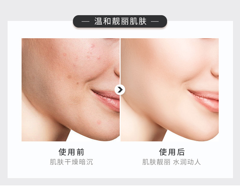 Wholesale Nicotinamide Blue Copper Peptide Lotion Rich Moist Lotion Moisturizing Hydrating Soothing Skin Care Water Supple Skin Water Wholesale Nicotinamide Blue Copper Peptide Lotion Rich Moist Lotion Moisturizing Hydrating Soothing Skin Care Water Supple Skin Water