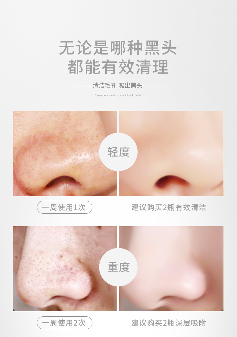 Cleansing Tearing Mask T District Care Acne Removing Blackhead Cutin Brightening Skin Hydrating Cleansing Nasal Membrane Cleansing Tearing Mask T District Care Acne Removing Blackhead Cutin Brightening Skin Hydrating Cleansing Nasal Membrane