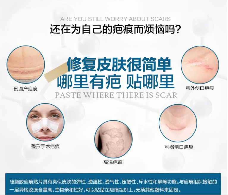 Breathable Silicone Sheet Scar Cesarean Section Transparent Waterproof Scar Paster Surgical Scar Fading Mark 35 12cmoem