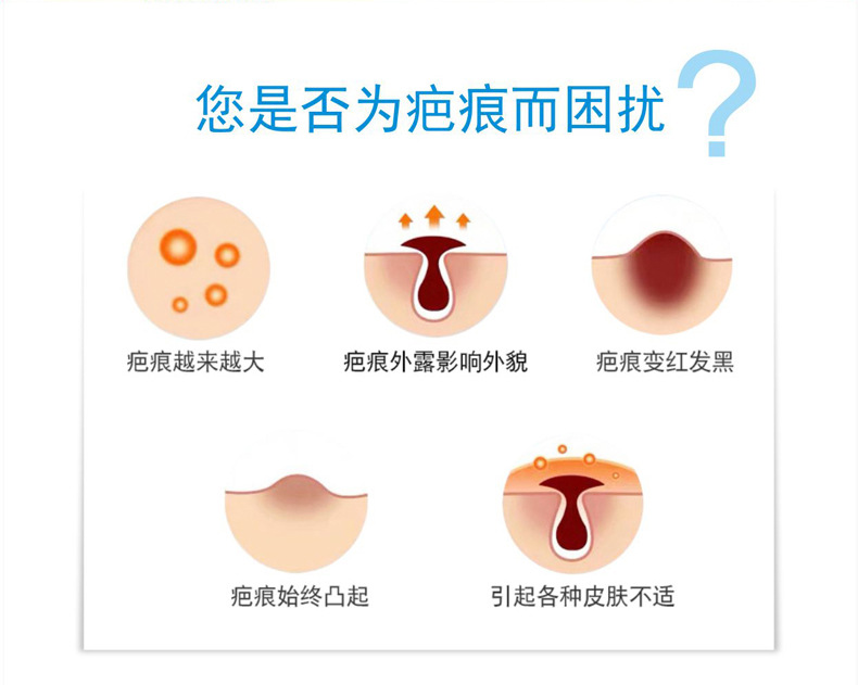 Medical Facial Acne Scar Acne Marks Children Trauma Scald Double Eyelid Surgery Hyperplasia Scar