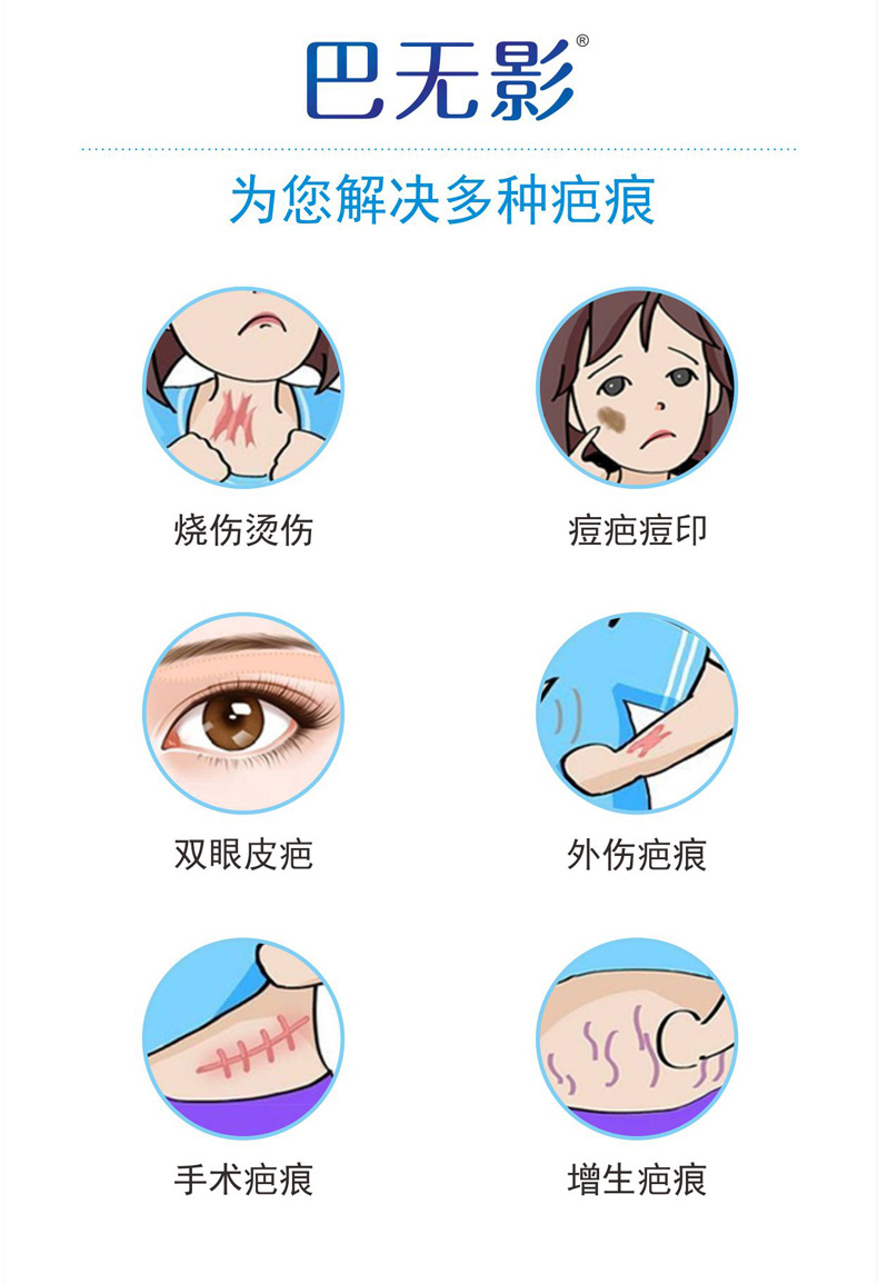 Medical Facial Acne Scar Acne Marks Children Trauma Scald Double Eyelid Surgery Hyperplasia Scar