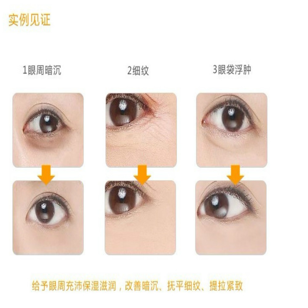 Rosotena Collagen Skin-Smoothing Eye Mask Slow down Eye Bags and Dark Circle Lifting and Tightening Eye Mask Rosotena Collagen Skin-Smoothing Eye Mask Slow down Eye Bags and Dark Circle Lifting and Tightening Eye Mask