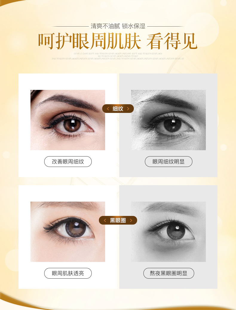 BEOTUA Nourishing Moisturizing Eye Cream Moisturizing Balance Moisturizing Gentle Care Eye Cream Eye Care Wholesale BEOTUA Nourishing Moisturizing Eye Cream Moisturizing Balance Moisturizing Gentle Care Eye Cream Eye Care Wholesale
