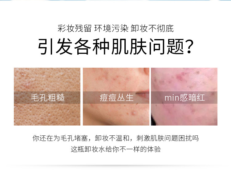 Feotznw Cleansing Water Eye, Lip and Face Three-in-One Gentle Cleansing Makeup Remover Milk Student Pump Bottle Female Makeup Remover Ointment Feotznw Cleansing Water Eye, Lip and Face Three-in-One Gentle Cleansing Makeup Remover Milk Student Pump Bottle Female Makeup Remover Ointment