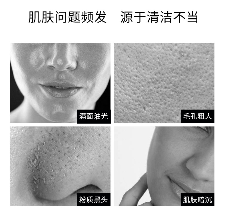 Xifei Shi Cleansing Acne Girls Facial Cleanser Oil Control and Water Supplement Amino Acid Men's Facial Cleanser Source Factory Wholesale