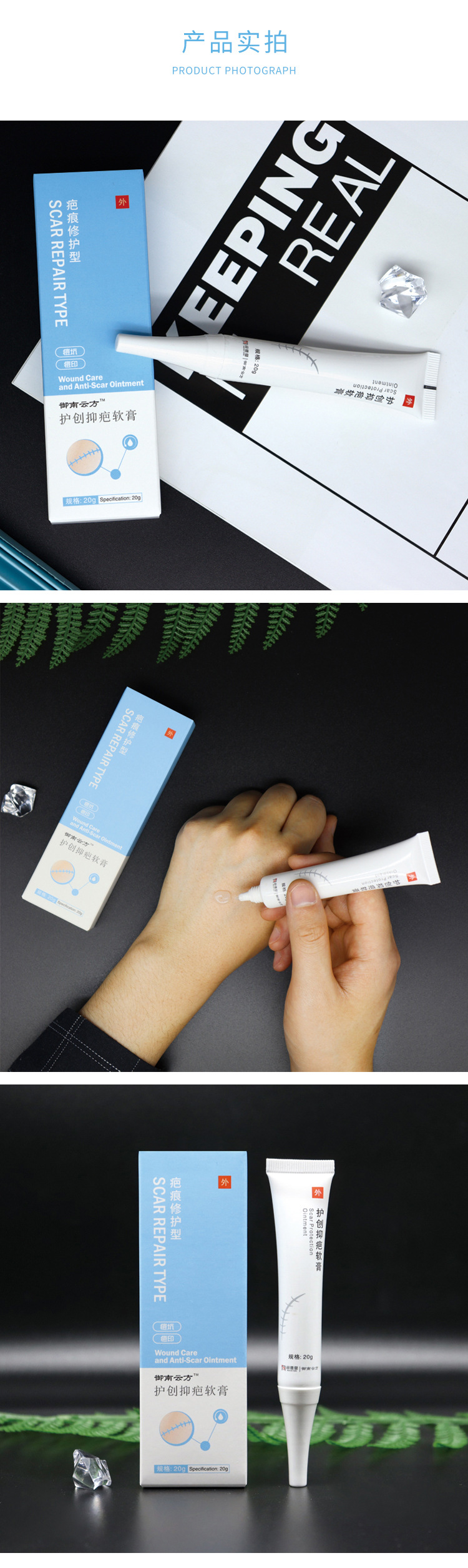 Non-Scar Care Double Eyelid Surgery Scar Skin Hyperplasia Care Burn Scald Cream Non-Removing Cream Non-Scar Removal Ointment Non-Scar Care Double Eyelid Surgery Scar Skin Hyperplasia Care Burn Scald Cream Non-Removing Cream Non-Scar Removal Ointment