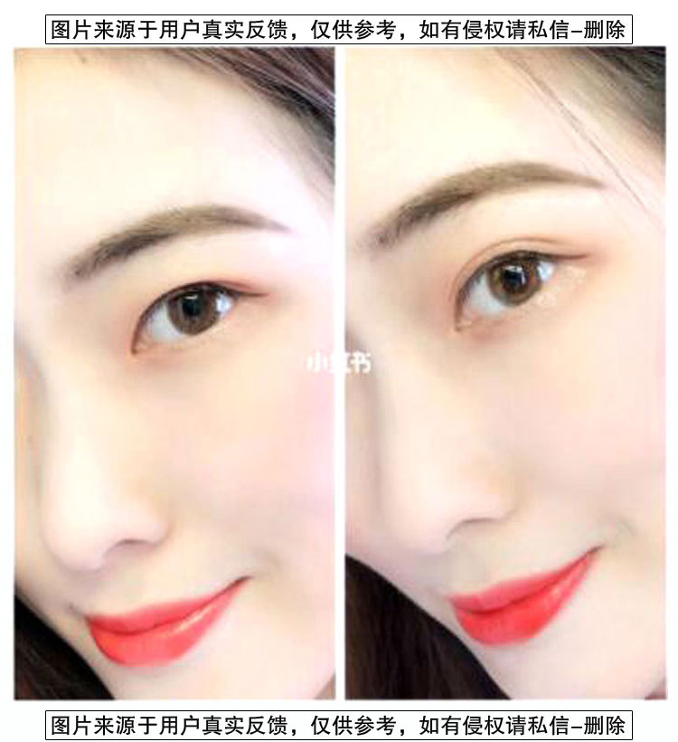 Lace Double Eyelid Stickers Olive Mesh Naturally Invisible Traceless Ventilation Skin Color Long-Lasting Double-Sided TikTok Same Style Wide