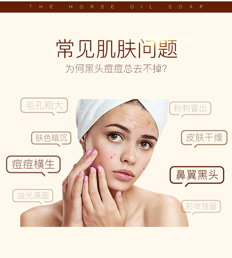 AntiMite Soap Sulfur Essential Oil Soap MiteRemoval Blackhead Wash Bath Men's and Women's Handmade Soap Whole Delivery AntiMite Soap Sulfur Essential Oil Soap MiteRemoval Blackhead Wash Bath Men's and Women's Handmade Soap Whole Delivery