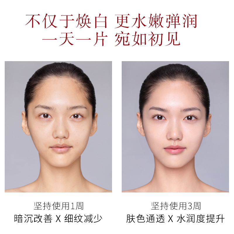 Hospital Line Beauty Salon Nicotinamide Mask Hydrating Moisturizing and Nourishing Silk Witch Mask Lady&#039;s Skin Care Products Wholesale