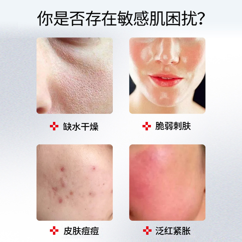 (Price Control) Chongzi Cold Compress Beauty Hospital Line Micro Needle Postoperative Red Blood Silk Sensitive Skin Repair Mask