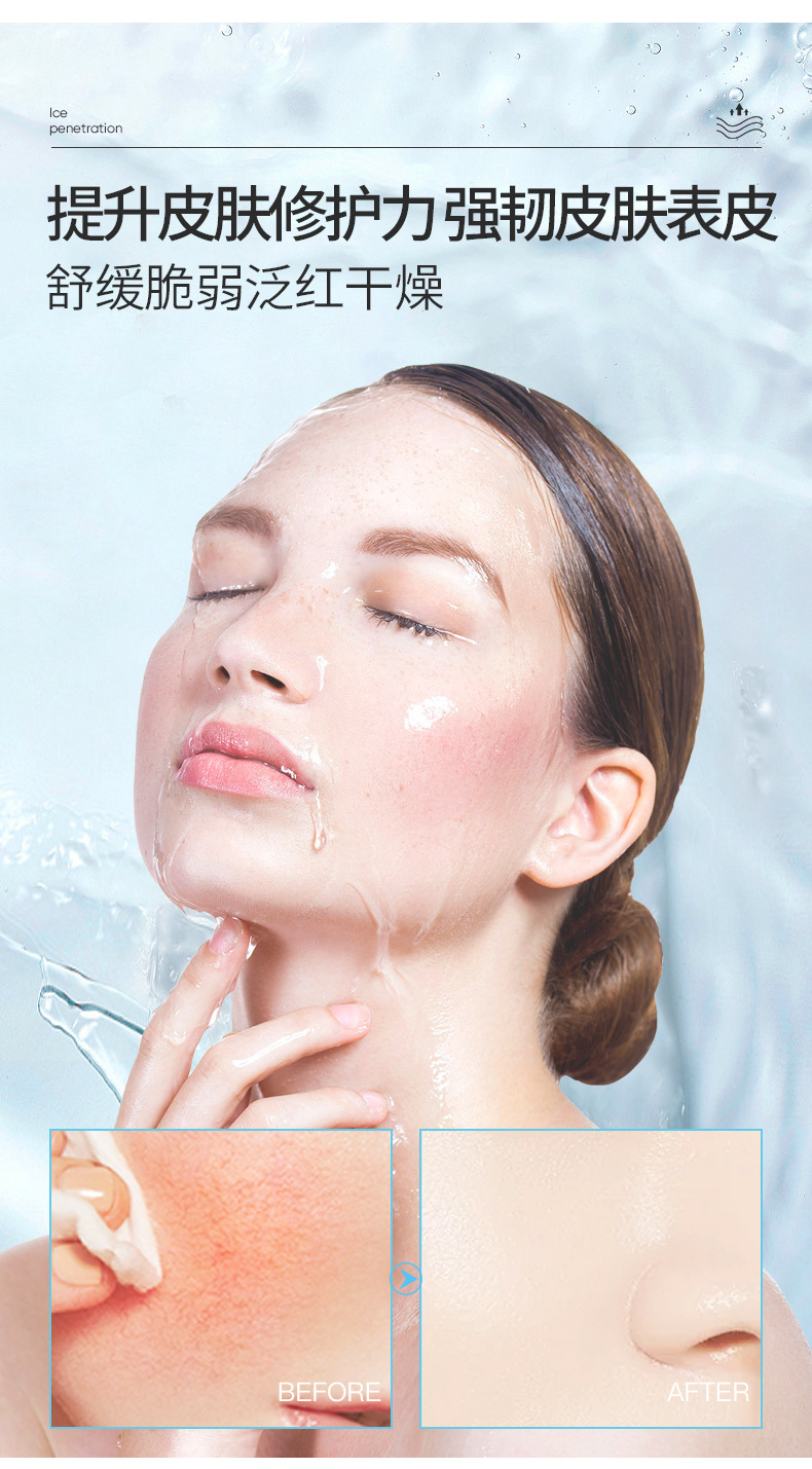 (Price Control) Chongzi Cold Compress Beauty Hospital Line Micro Needle Postoperative Red Blood Silk Sensitive Skin Repair Mask