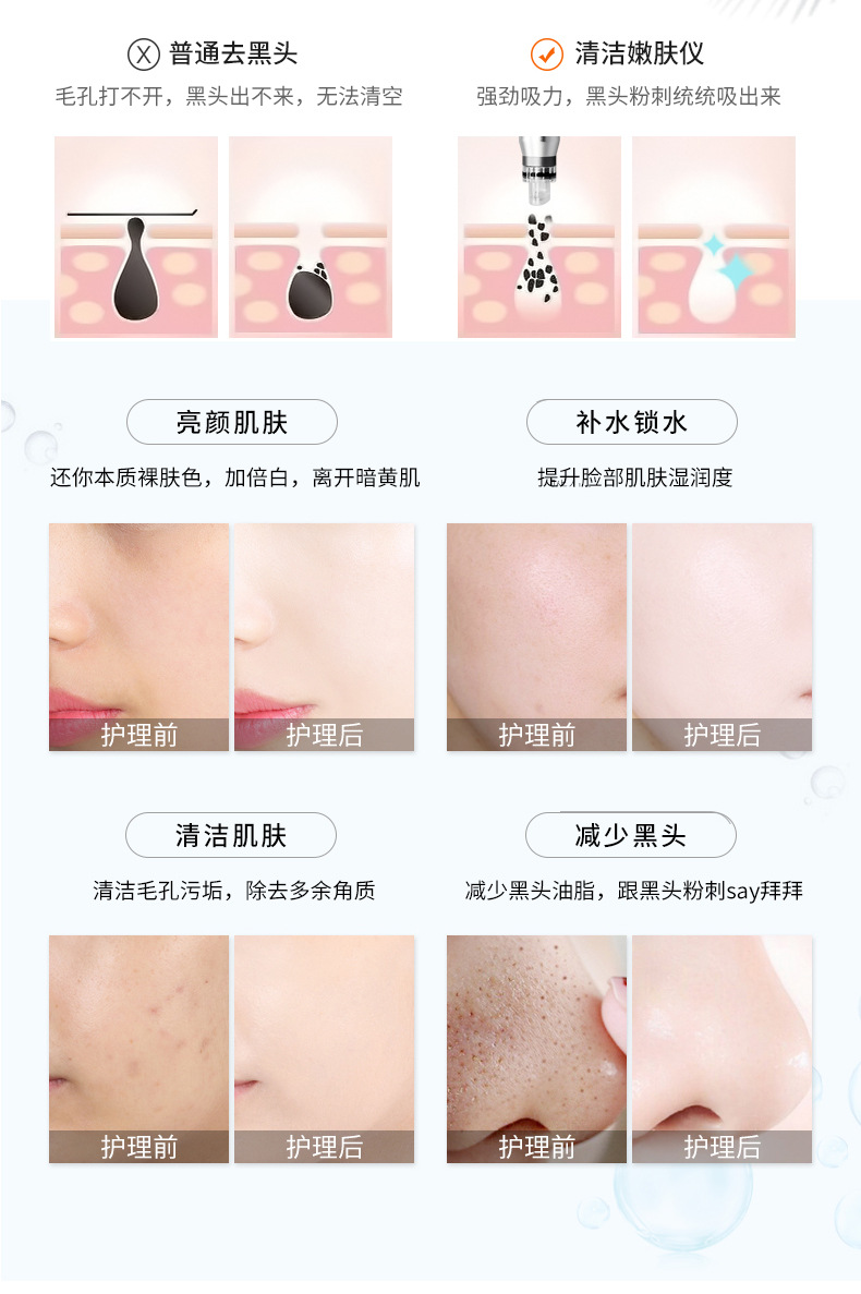 Korean Generation Hydrogen and Oxygen Small Bubble Introduction Oxygen Injection Blackhead Removing Hydrating Radio Frequency Device Comprehensive Beauty Salon Beauty Instrument