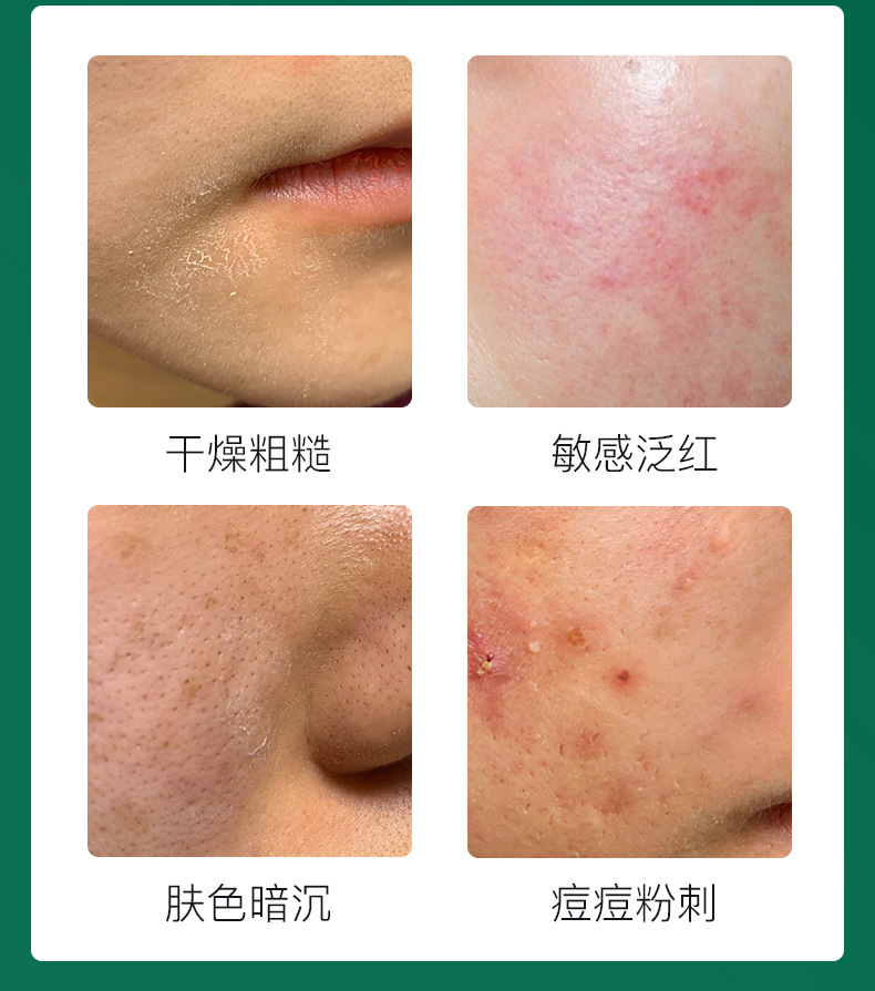 QMHUT Genuine Goat's Milk Skin Beauty Mask Tender and Smooth Hydrating Brightening Skin Lock Water Nourishing Repair Moisturizing Mask QMHUT Genuine Goat's Milk Skin Beauty Mask Tender and Smooth Hydrating Brightening Skin Lock Water Nourishing Repair Moisturizing Mask