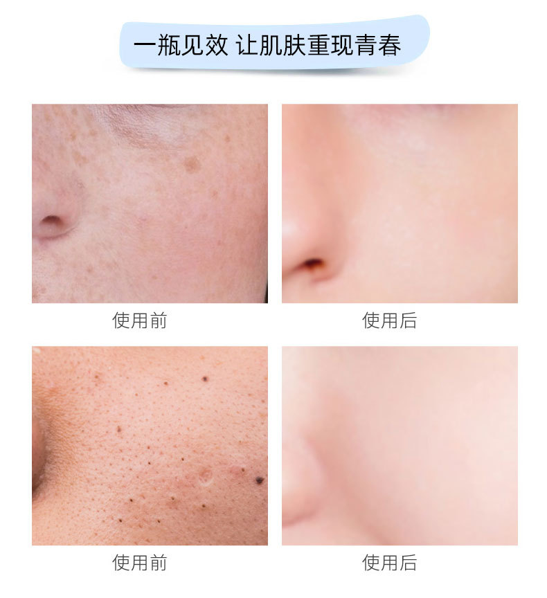 Zhi Ran Mei Facial Massage Cream Balance Acid and Alkali Beauty Cleansing Pore Purification Balance Massage Cream