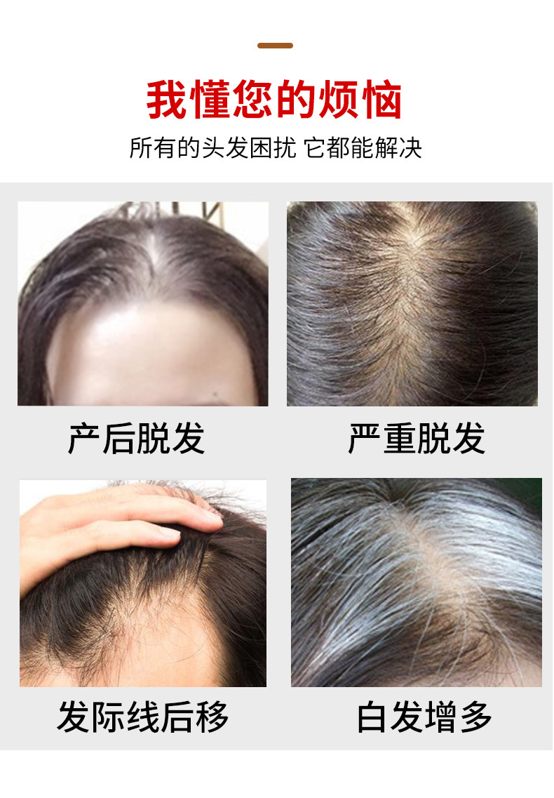 Wig Women's Long Hair Head Replacement Hair Extension Silk Mesh Bottom Human Hair Head Hairpiece Cover Gray Hair Wig Set