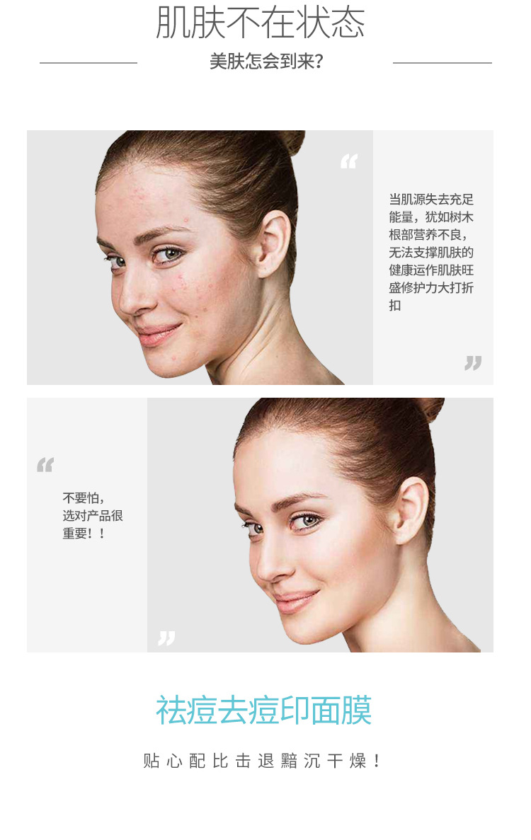 Salicylic Acid Acne Soothing Anti Smallpox Diluting Restoring Mask Processing Tear Shi Mask Wholesale