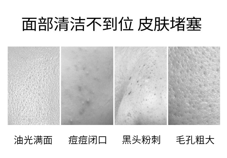 Lan Tianji Green Tea Mud Film Clean Mud Film Remove Blackhead Moisturizing Oil-Control Men Volcano Mung Bean Mud Mask