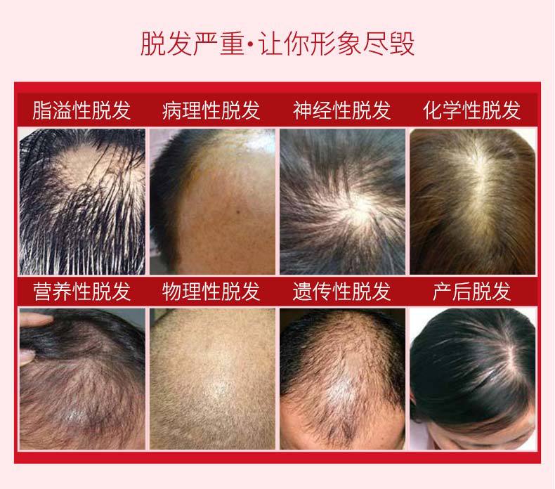 Whole Miyashi Antioff Hair Renewal Liquid Little Red Bottle Essence Nourishing Hair Root Plant Hair Care Essential Oil