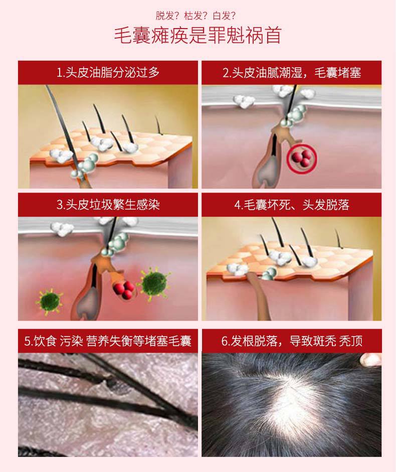 Whole Miyashi Antioff Hair Renewal Liquid Little Red Bottle Essence Nourishing Hair Root Plant Hair Care Essential Oil