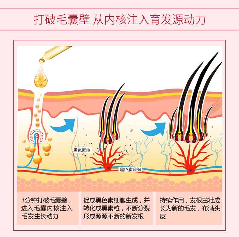 Whole Miyashi Antioff Hair Renewal Liquid Little Red Bottle Essence Nourishing Hair Root Plant Hair Care Essential Oil