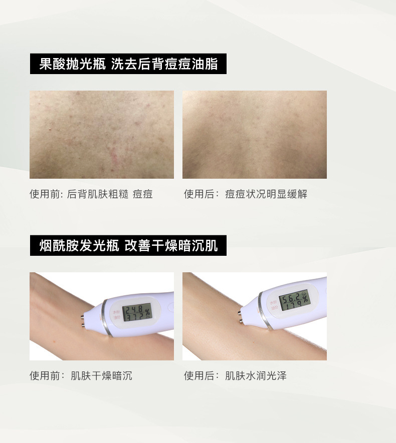RNW Shower Gel Tartaric Acid Whitening Toner Moisturizing Body Moisturizing Fragrance Fragrance Family Pack Unisex Official